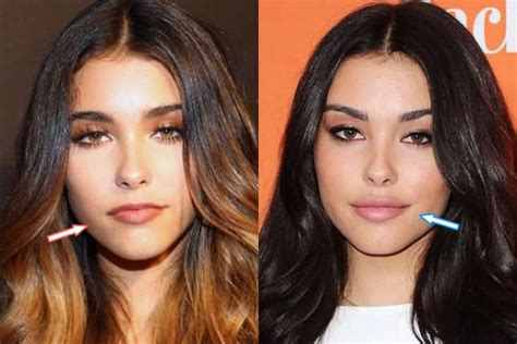 does madison beer have a boob job|People Think Madison Beer Had a Plastic Surgery,。